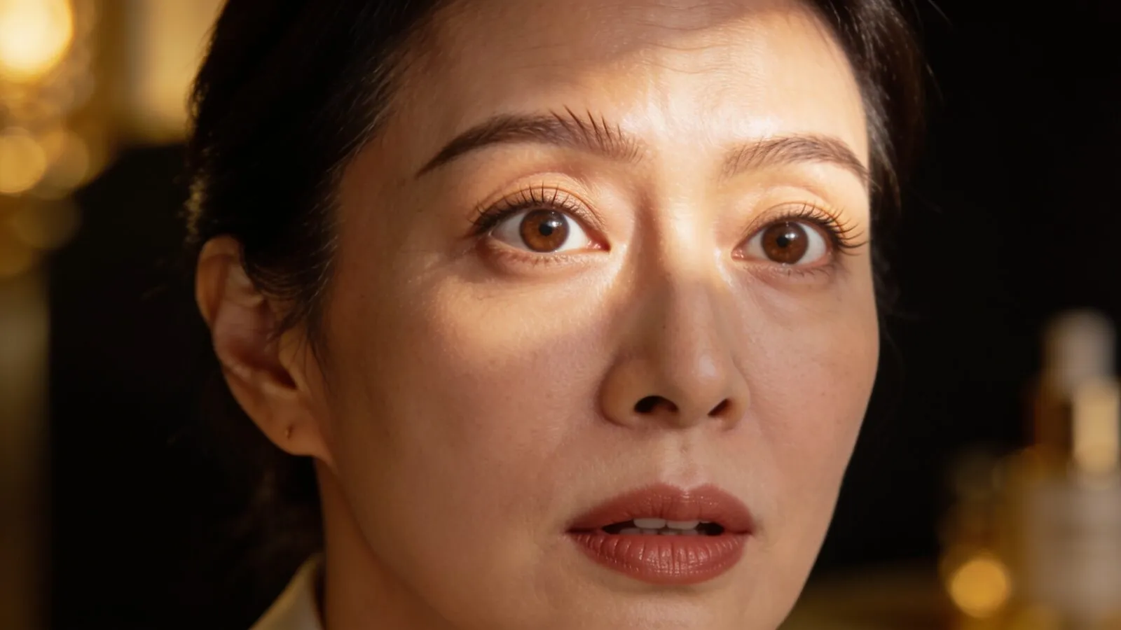 Assessment of dynamic versus static forehead lines and crow's feet, Dr Sin Yong Singapore