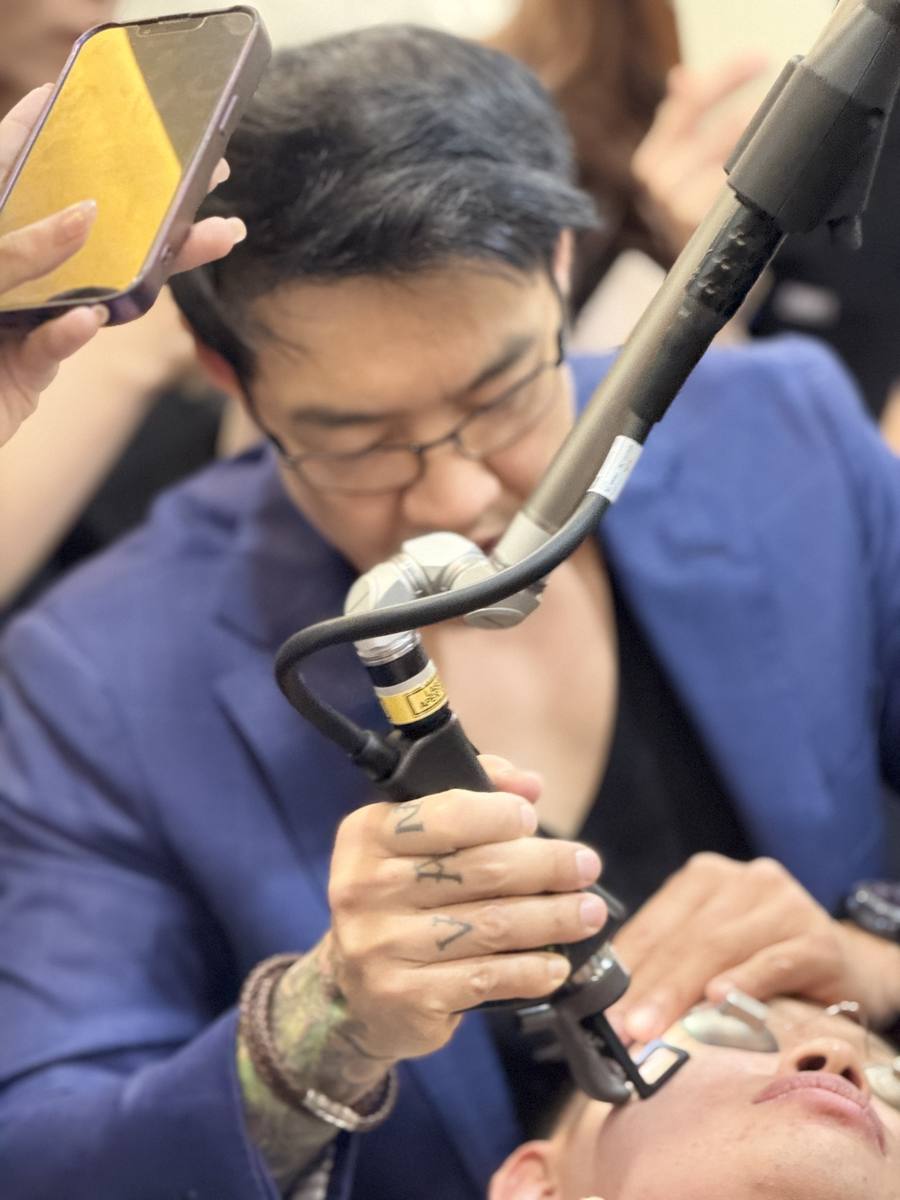 Close-up of Dr Davin Lim performing DEKA Tetra Pro CO2 laser resurfacing on Dr Sin Yong's face — acne scar treatment demonstration