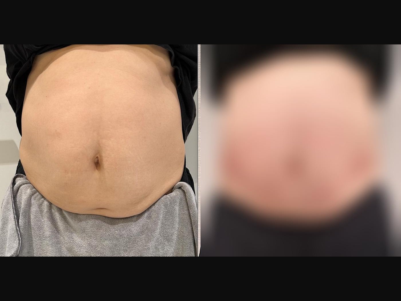 VF Body - Sculpts & Tightens Tummy